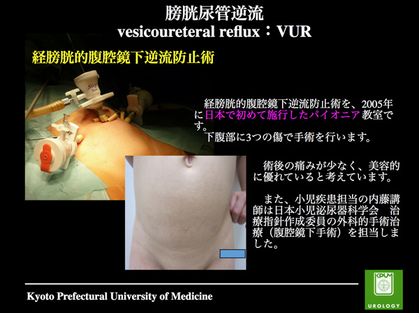 患者様へ | 京都府立医科大学泌尿器科学教室